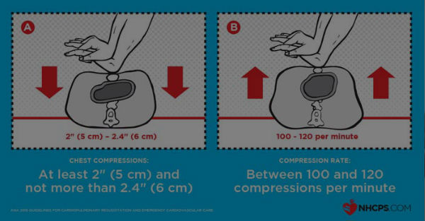 AHA2015guidelines