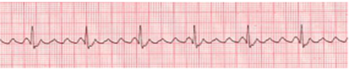 figure 38