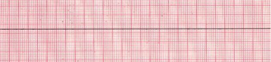 ECG Strip