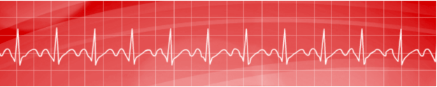 Sinus Tachycardia