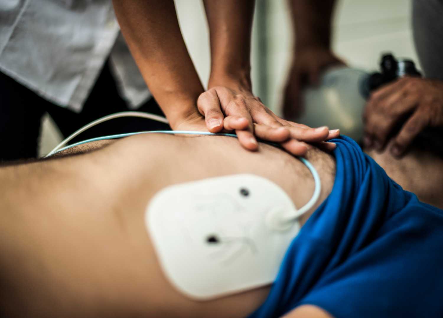 Performing CPR on a patient with an AED pad.